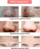 Masque LED Photothérapie